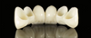 Taji za All-Ceramic &Zirconia