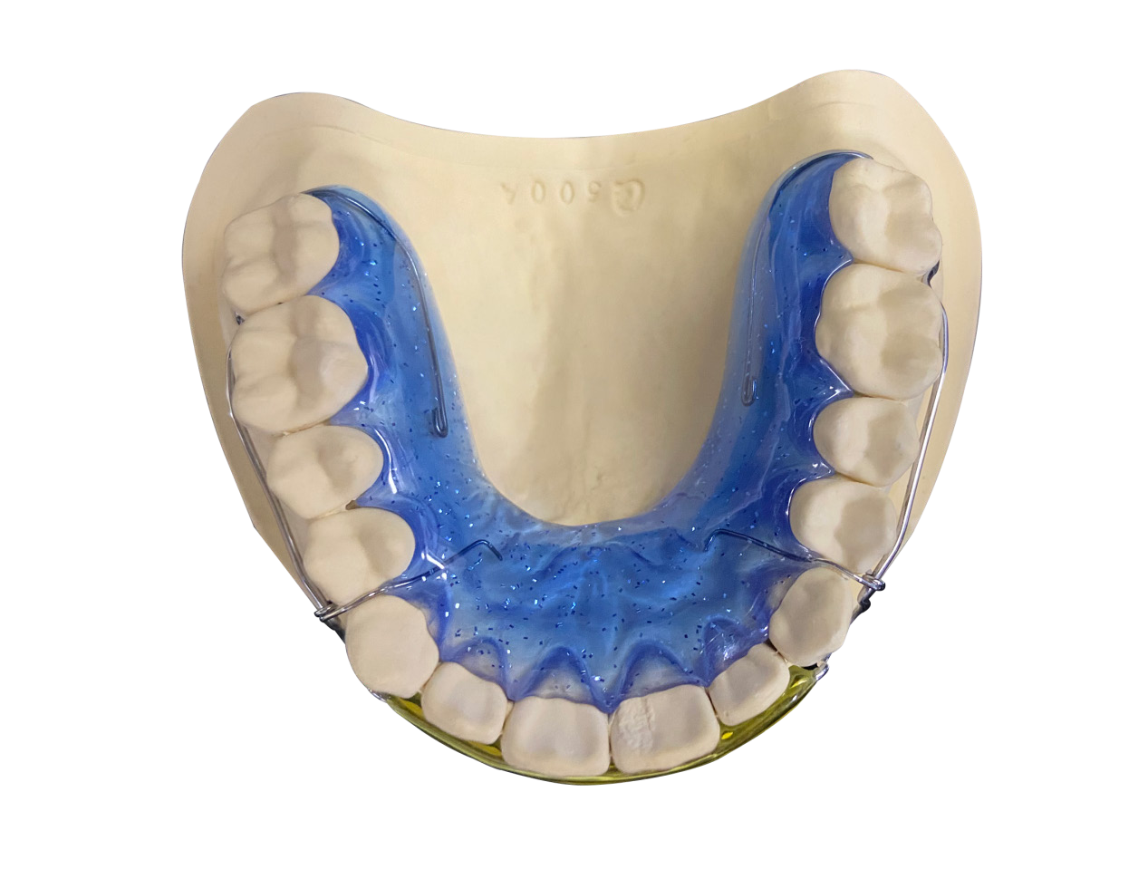 Dental Lab Outsourcing 101 – When and Why to Outsource Your Lab Work