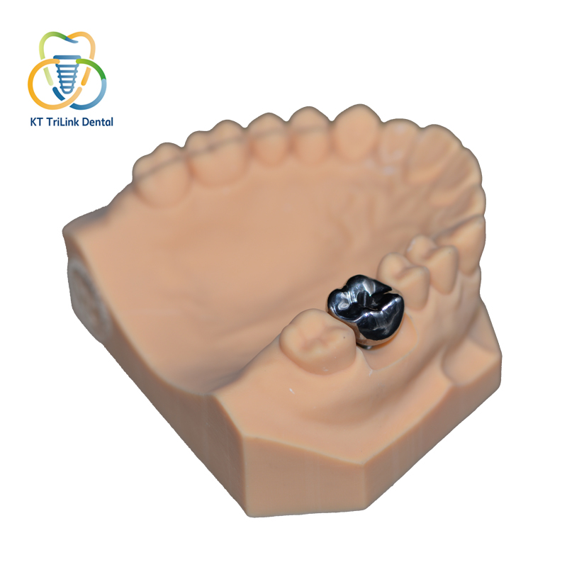 Implant&aacute;t PFM Monoblok Crown (Co-Cr)
