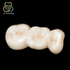 Ceromer Dental Crown