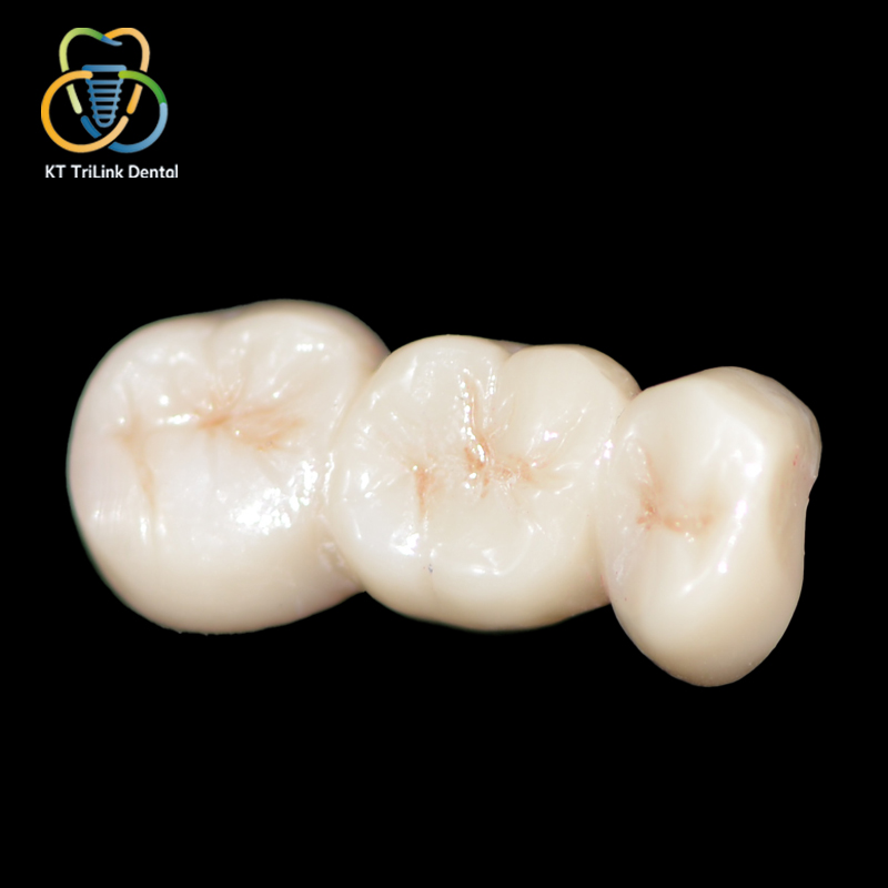 Ceromer Dental Crown