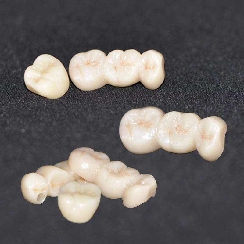 Ceromer Dental Crown