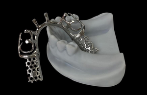 Staffe metalliche